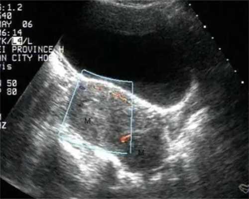 上海试管助孕：技术、伦理与合法性深度解析